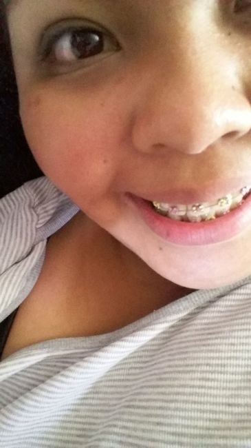 Novia con brackets?! :( - 2