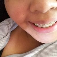 Novia con brackets?! :( - 2