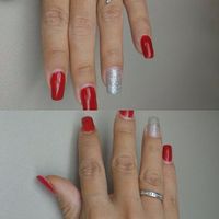 anillos 