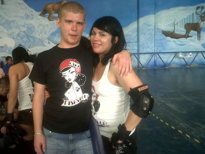mi novio sin cabello