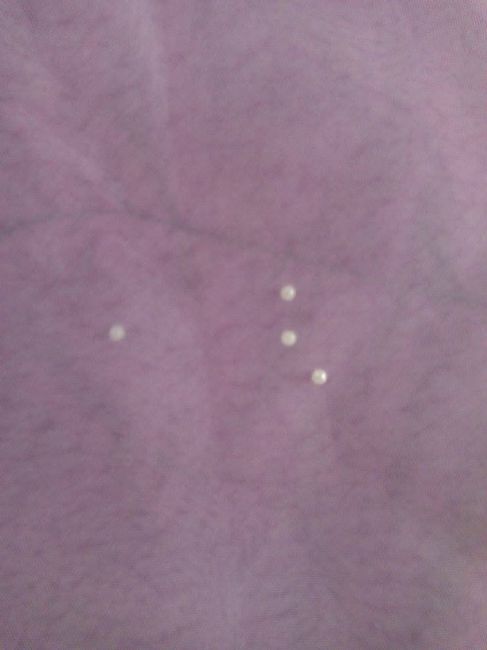 DETALLES