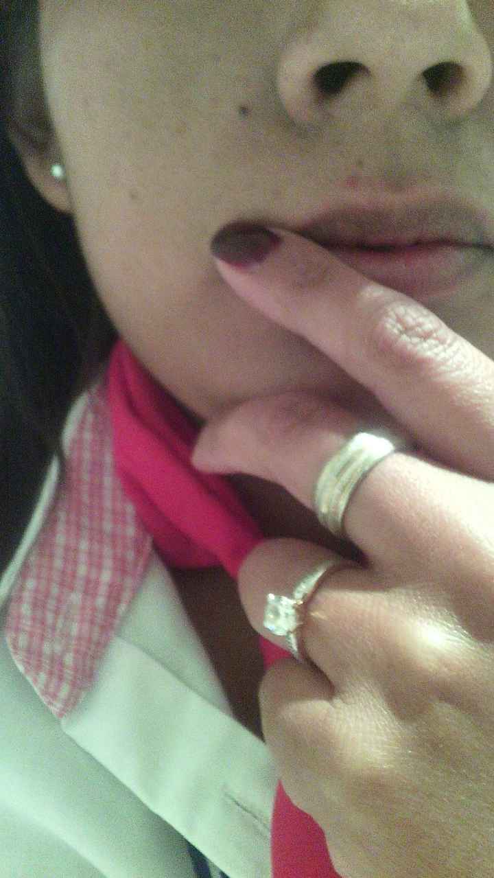 Mi hermso anillo