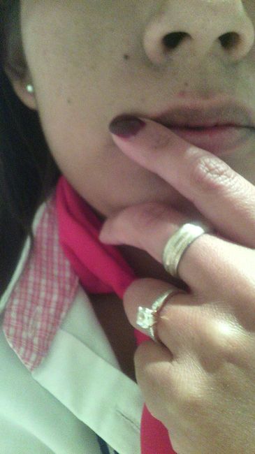 Mi hermso anillo