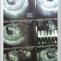 11 semanas