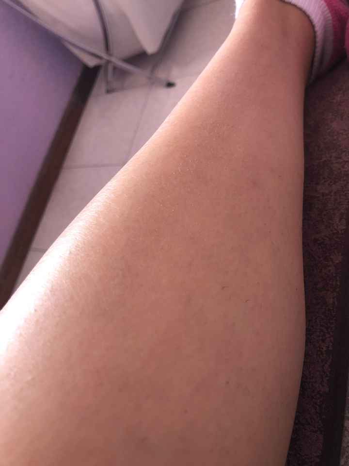 Mi experiencia con la depilación permanente - 2