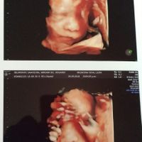 Nuestro 3 aniversario, en compañía de nuestro primer bebé!! 😍😍♥️ - 1