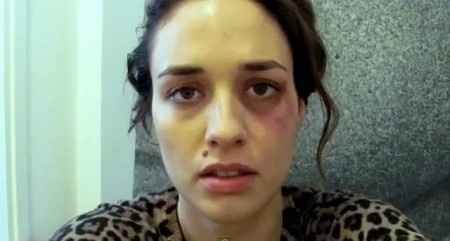 El maltrato a una mujer durante todo un año, en 365 fotos