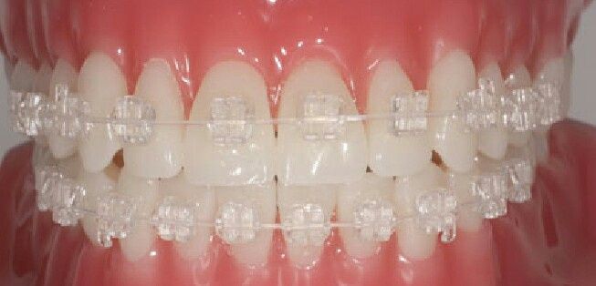 Sonreir en fotos?? ... :s - 1