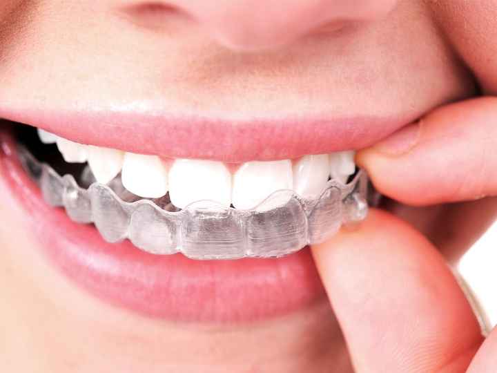Novia con brackets - 1