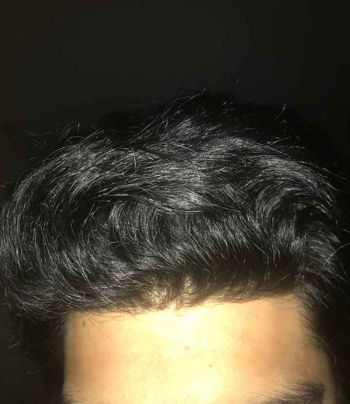 Dejo 3 fotos de mi cabello 