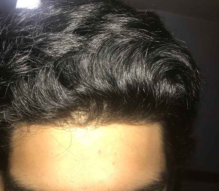 Dejo 3 fotos de mi cabello 