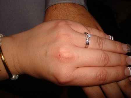 mi hermoso anillo