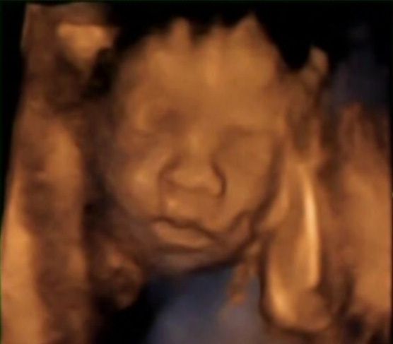 Estoy feliz acabo de ver a mi nene en 4d - 1