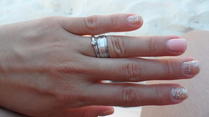 anillo