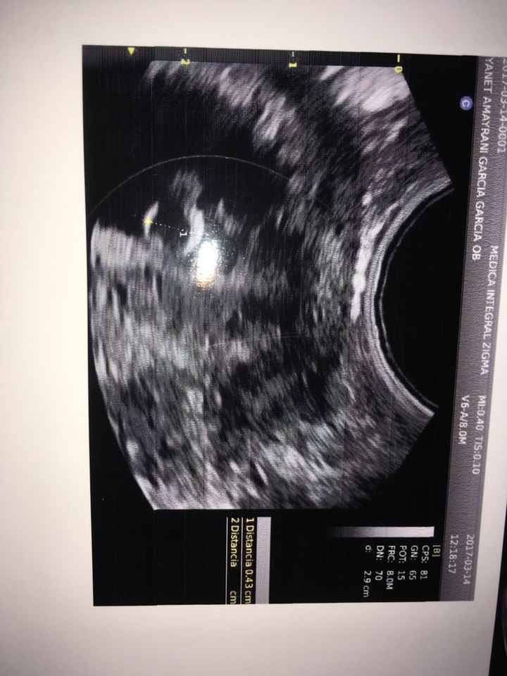 Bebe a bordo 🤰🏼 🤰🏼🤰🏼👶🏻 - 2