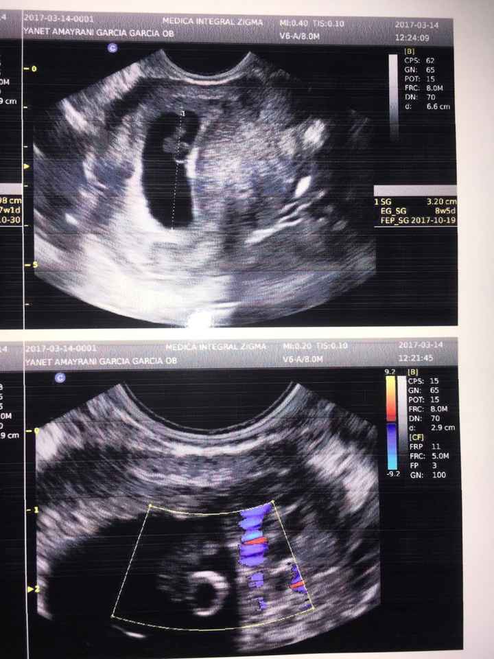 Bebe a bordo 🤰🏼 🤰🏼🤰🏼👶🏻 - 3