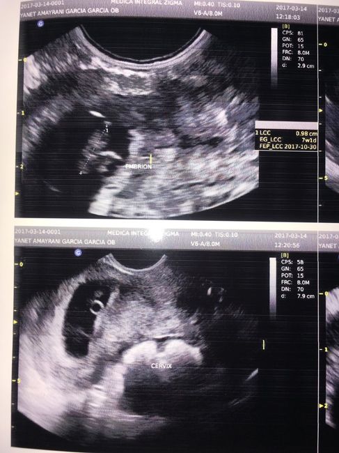 Bebe a bordo 🤰🏼 🤰🏼🤰🏼👶🏻 - 4