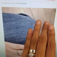 anillos