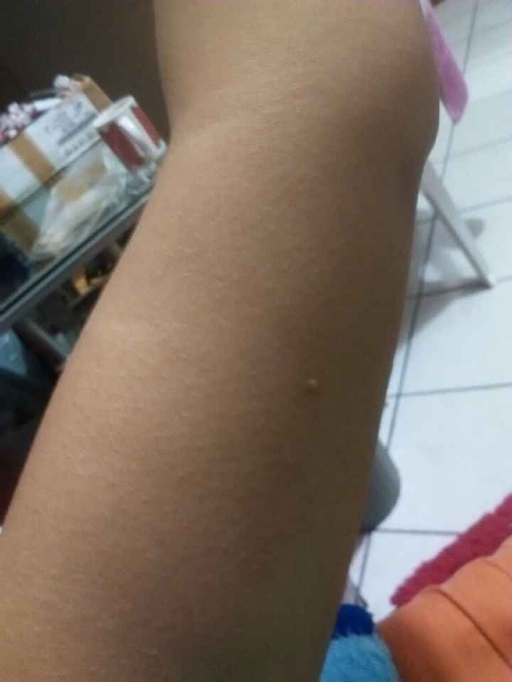 Fui al ginecólogo  ? - 1