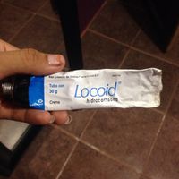 Me salió un fuego!!! :( - 1