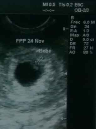 Les presento a mi bb - 1