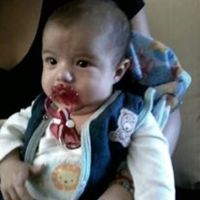 MI   ENANO 