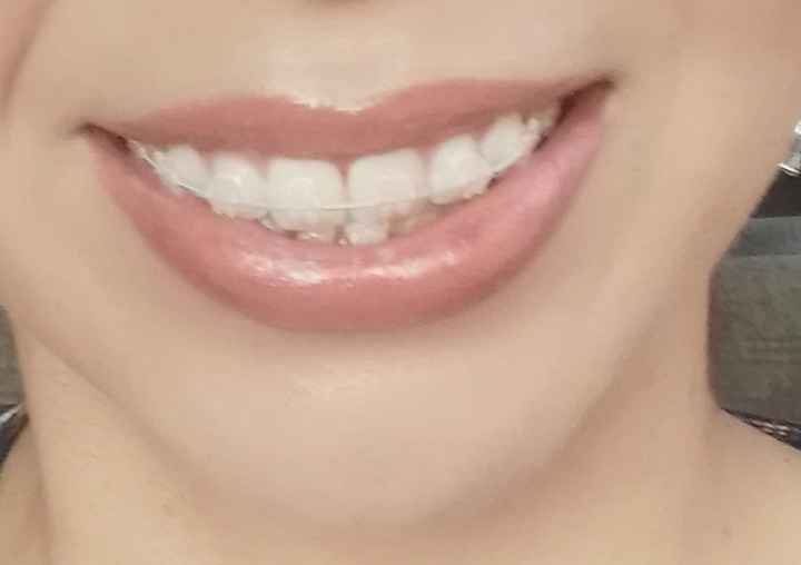 Labial: ¿claro u oscuro? - 1