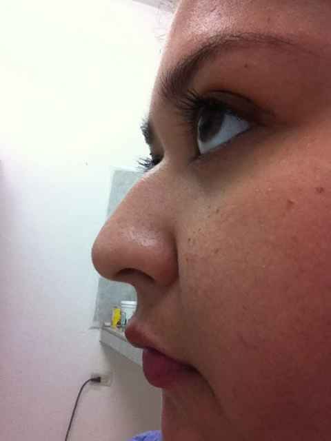 Nariz nueva - 1