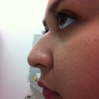 Nariz nueva - 1