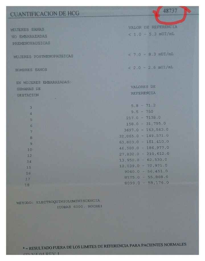 Ayuda con interpretación de resultados - 1