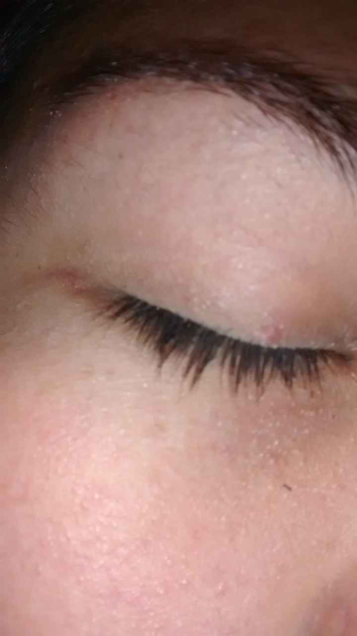 Un granito :( - 2