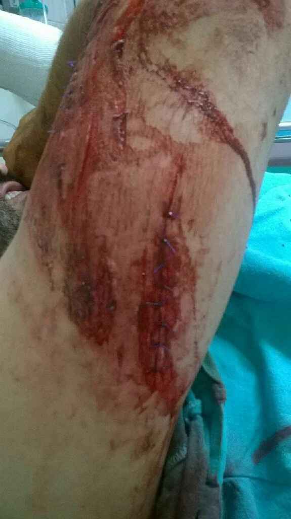 Avances rústicos a 4 días .. y la tragedia - 7