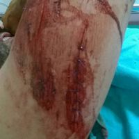 Avances rústicos a 4 días .. y la tragedia - 7