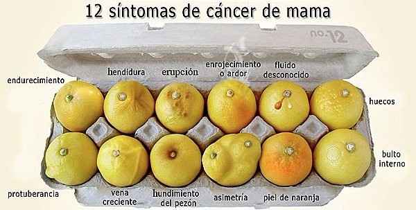 cancer de mama