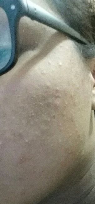 Ayuda chicas mi cutis esta super mal - 1