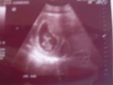MI CHAPARRITO
