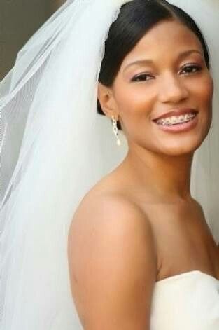 ¡novias con brackets! - 2