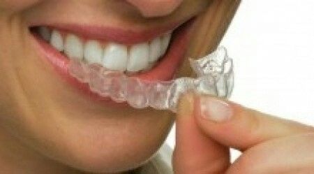 ¡novias con brackets! - 5