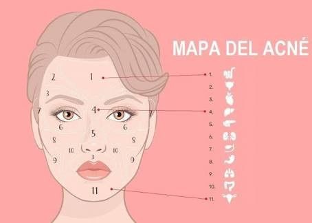 Tips para eliminar el acne - 3