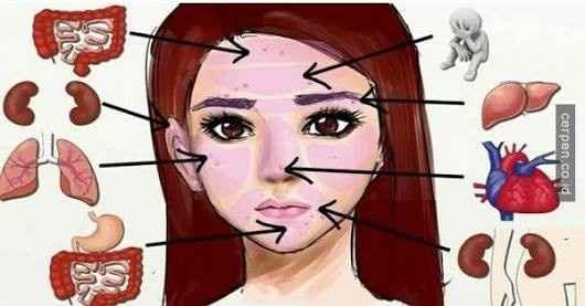 Tips para eliminar el acne - 2