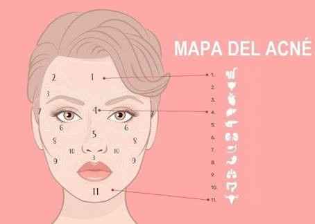 Tips para eliminar el acne - 3