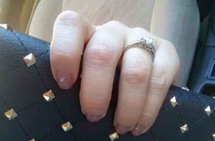anillo