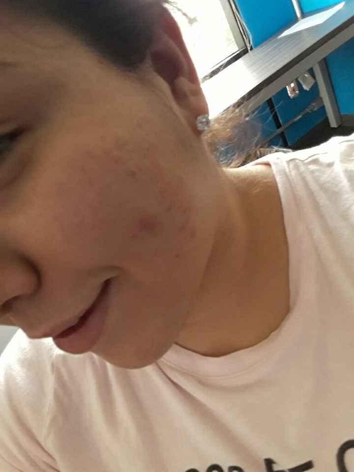  Mi carita sufre el stressss - 1