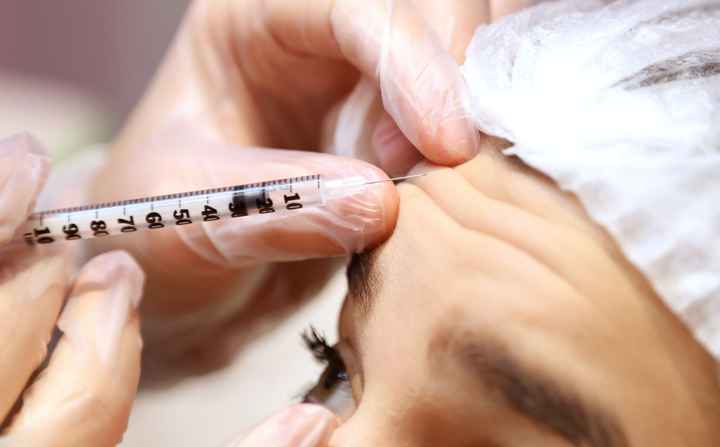 ¿Te pondrías botox? - 1