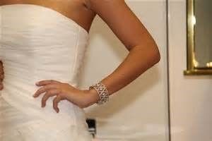 brazalete 3