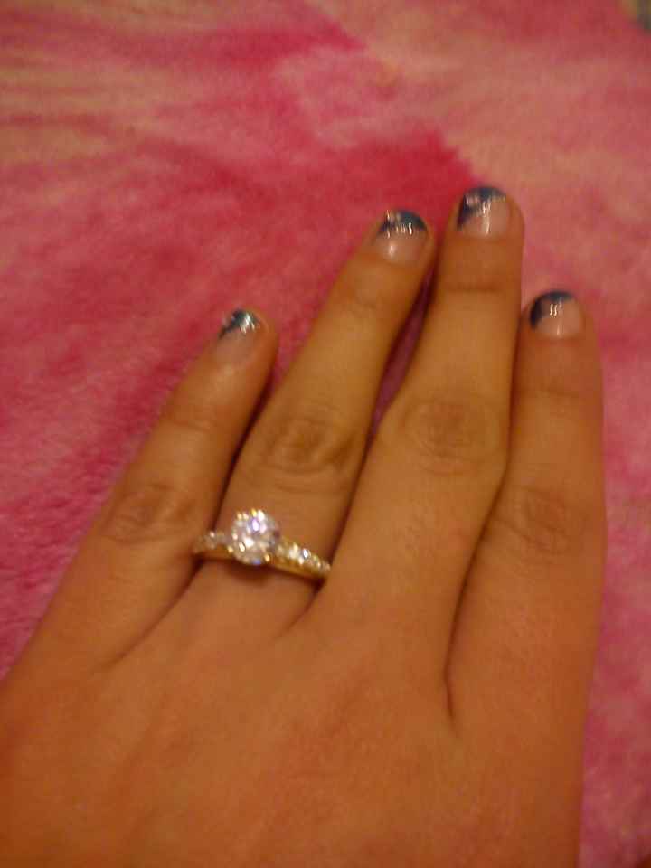 anillo