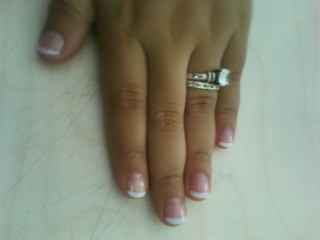 anillo