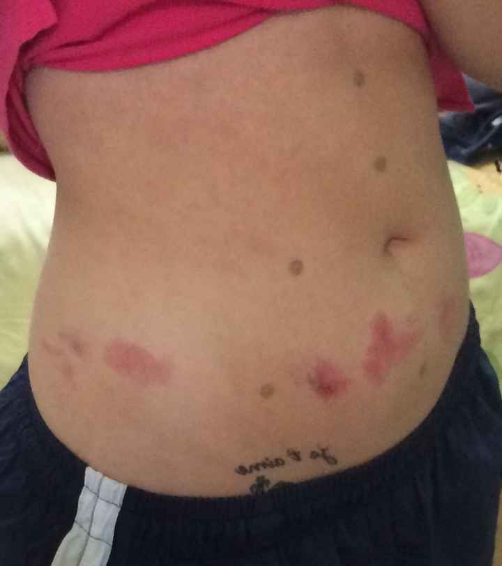 La belleza cuesta ! - 1