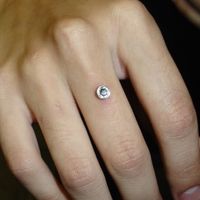 Perforaciones de compromiso