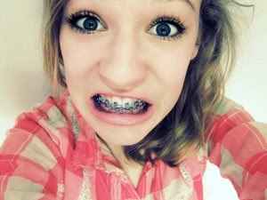 Novia con brackets?! :( - 1